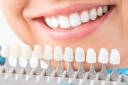 Mending and Preserving Teeth Aesthetics through Aesthetic Dentistry