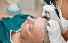 Hair Transplantation in the Medical Tourism Industry